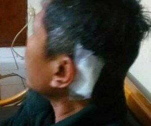 Bagian belakang sopir taksi online luka dianiaya perampok