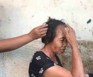 Nenek pedagang sayur keliling disiram air keras oleh orang tak dikenal.