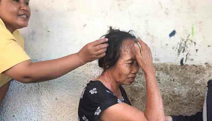 Nenek pedagang sayur keliling disiram air keras oleh orang tak dikenal.