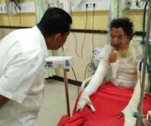 Petugas meminta keterangan pada pria yang bakar diri di Pondok Ranggon, Jakarta Timur. (ifand)