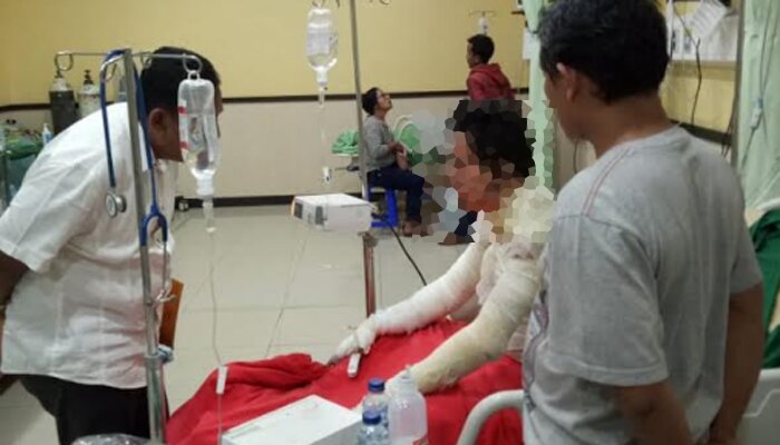 Pria yang bakar diri dirawat di RS Polri Kramatjati.(ifand)